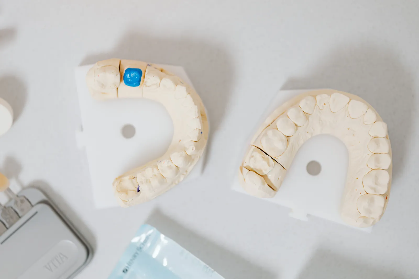 Couronne en zircone : solidité et rendu naturel